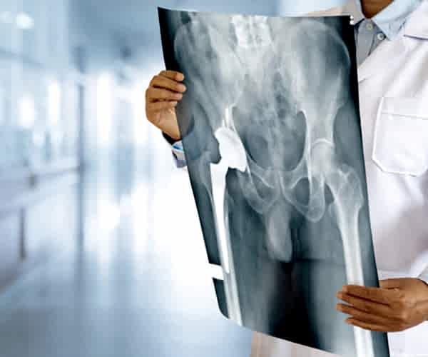 Pelvik Taban Rehabilitasyonu